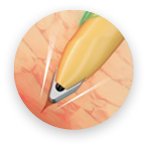 Punção automática - Sistema de proteção